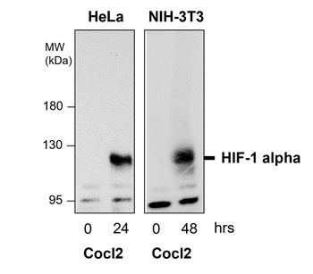Angiogenesis Antibody Panel