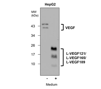 Angiogenesis Antibody Panel