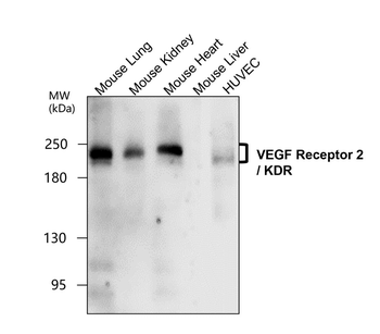 Angiogenesis Antibody Panel