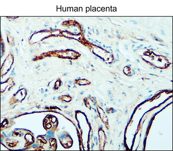 Angiogenesis Antibody Panel