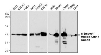 Angiogenesis Antibody Panel