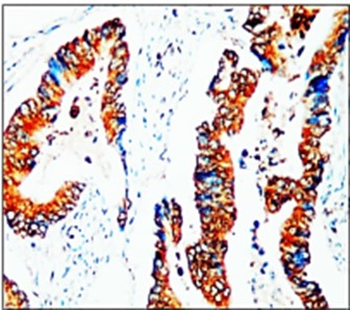 Cancer Stem Cell Antibody Panel