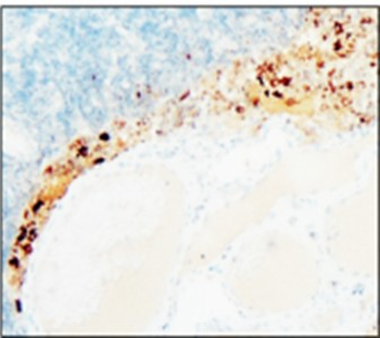 Cancer Stem Cell Antibody Panel