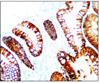 Cancer Stem Cell Antibody Panel