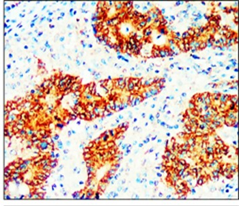 Cancer Stem Cell Antibody Panel