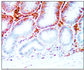Cancer Stem Cell Antibody Panel