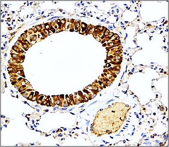 Inflammasome Antibody Panel