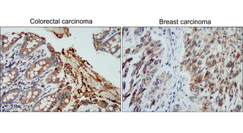 Matrix Remodeling Antibody Panel