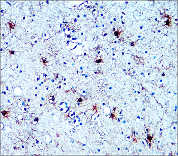 Traumatic Brain Injury (TBI) Biomarker Antibody Panel