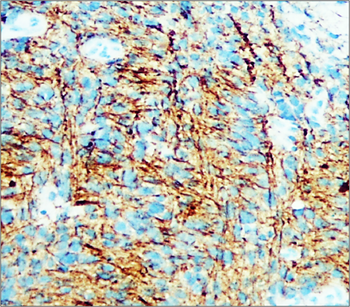 Traumatic Brain Injury (TBI) Biomarker Antibody Panel