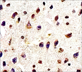 Traumatic Brain Injury (TBI) Biomarker Antibody Panel