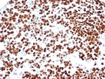 Recombinant TP53 Antibody / p53
