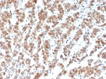 Apolipoprotein J Antibody / APO-J / Clusterin
