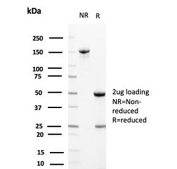 Apolipoprotein J Antibody / APO-J / Clusterin