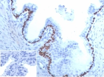 Recombinant p63 Antibody / Tumor protein 63