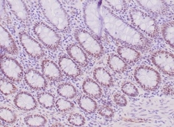 Recombinant MLH1 Antibody / MutL Homolog 1