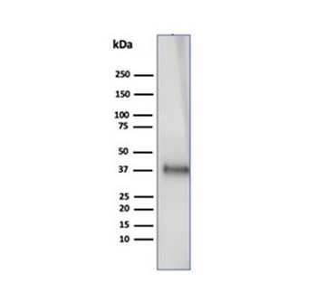 CLU Antibody / Clusterin / Apolipoprotein J / APO-J