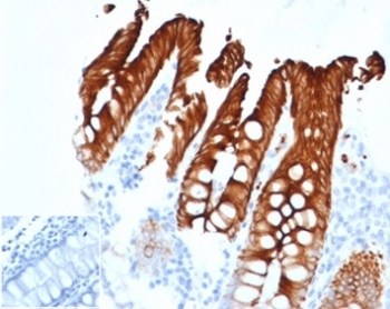 Recombinant Keratin 20 Antibody / CK20 / Cytokeratin 20