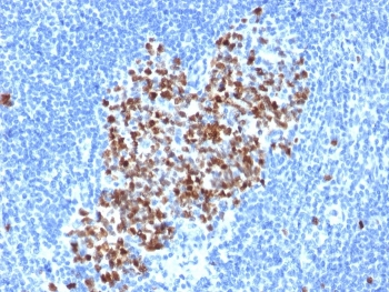 Recombinant TOP2A Antibody / Topoisomerase II alpha