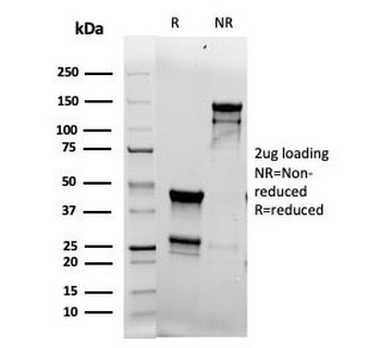 Recombinant TOP2A Antibody / Topoisomerase II alpha