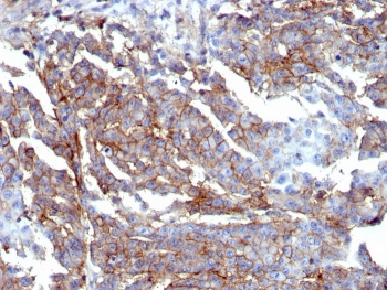 Recombinant CD44 Antibody / HCAM