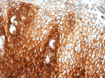 Recombinant CD44 Antibody / HCAM