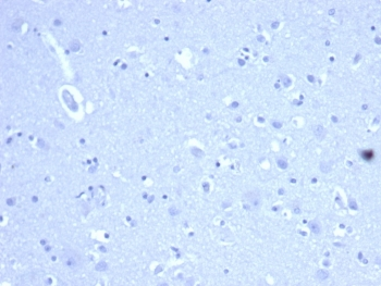 Recombinant CD44 Antibody / HCAM