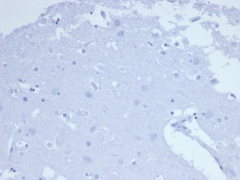 Recombinant CD7 Antibody