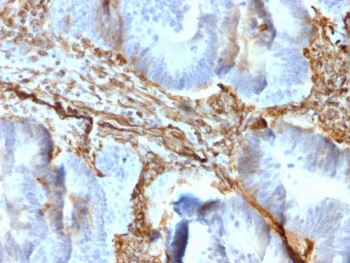Recombinant VIM Antibody / Vimentin