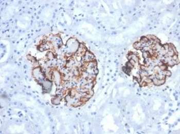 Recombinant Vimentin Antibody