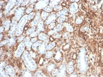 Recombinant Vimentin Antibody