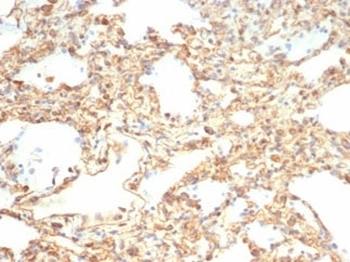 Recombinant Vimentin Antibody