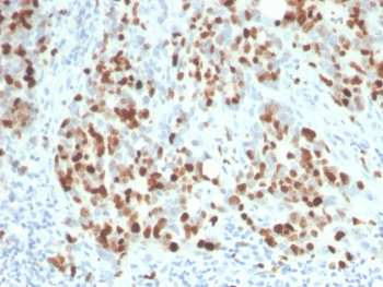 Recombinant Ki67 Antibody