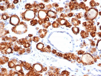 Recombinant TPO Antibody / Thyroid Peroxidase