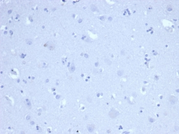 Recombinant Ki-67 Antibody