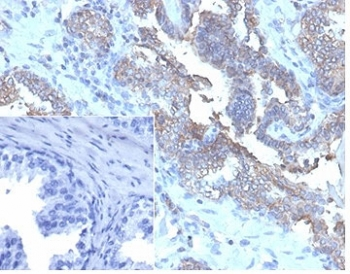 Recombinant CD47 Antibody / IAP / Integrin Associated Protein