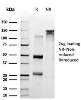 SET Antibody / Protein SET / TAFI
