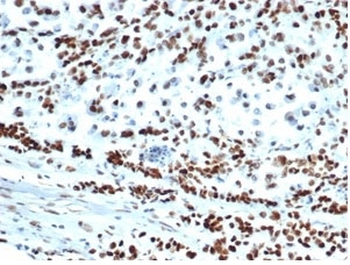 Recombinant MSH6 Antibody