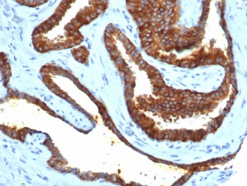Recombinant CD38 Antibody