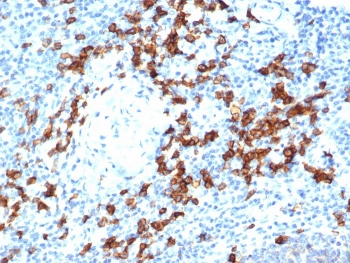 Recombinant CD38 Antibody