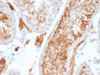 Recombinant INHA Antibody / Inhibin alpha