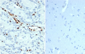 Recombinant ERG Antibody / Transcriptional regulator ERG