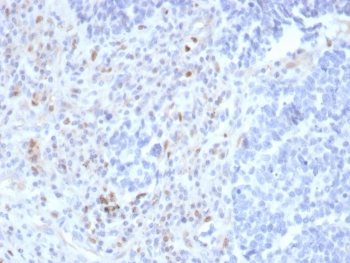 Recombinant PU.1 Antibody / SPI1
