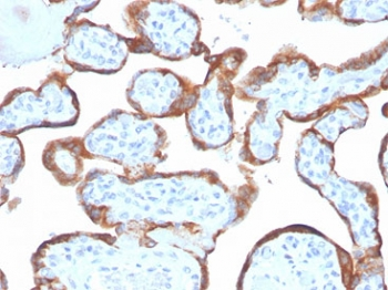 TIMP2 Antibody