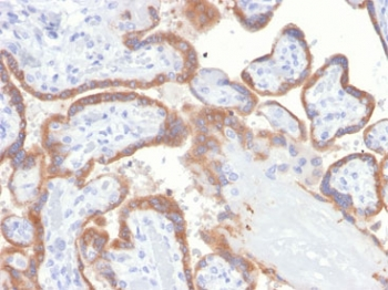 TIMP2 Antibody