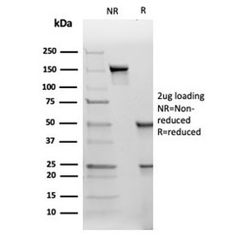 TIMP2 Antibody