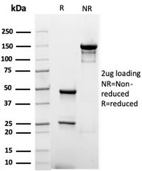 Albumin Antibody