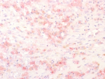 Tyrosinase-Related Protein-1 Antibody / TRP1 / TYRP1