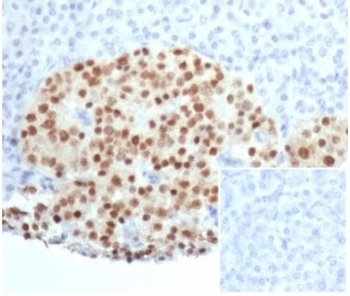 Recombinant PAX6 Antibody