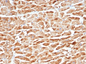 Recombinant SDHB Antibody